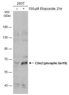 Western Blot: Chk2 [p Ser19] Antibody [NBP3-13328]